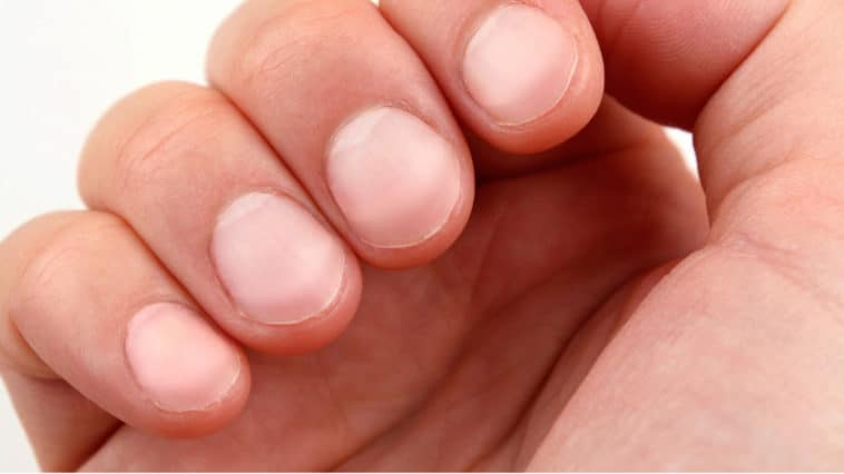 Fingernails tell about health