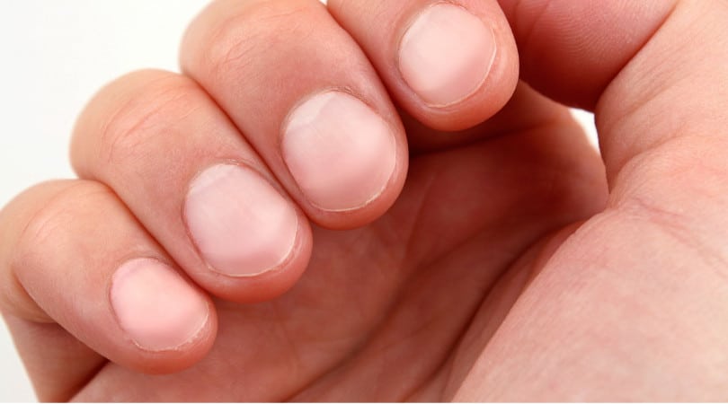 Fingernails tell about health
